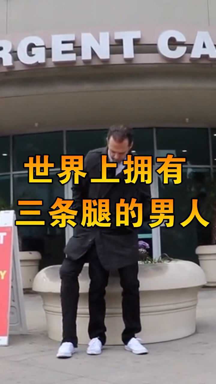 真的有三条腿的人吗伦蒂尼拥有三条腿靠自己的残疾为生