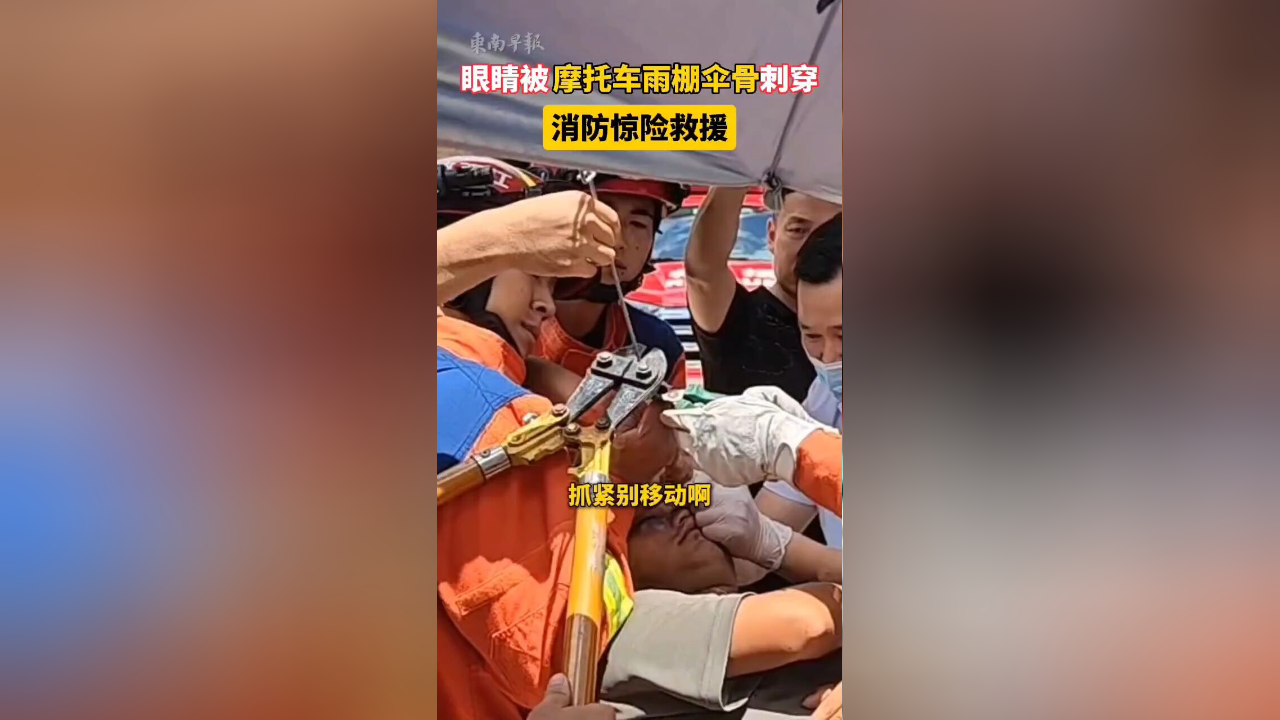 男子眼睛被摩托车雨棚伞骨刺穿
