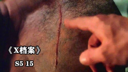 《X档案S5-15》男子身上有道疤痕，体内被移植了吃人的怪物