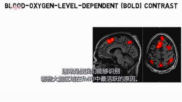 2分钟神经科学功能磁共振成像(FMRI)