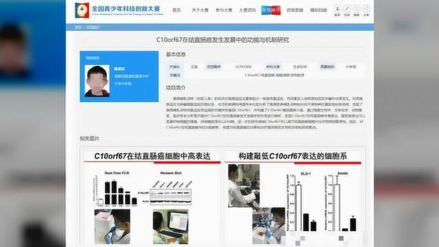 六年级小学生研究基因抗癌获奖,网友:他开挂