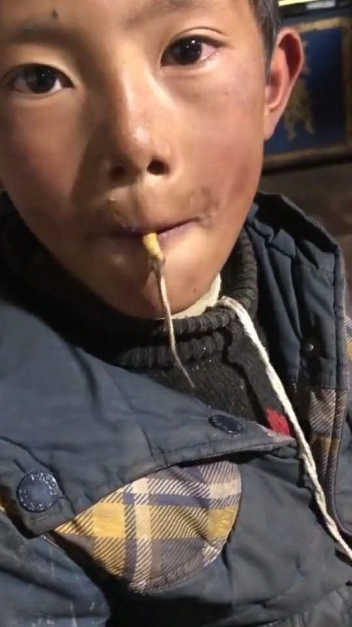 中国贫困山区儿童饥饿图片