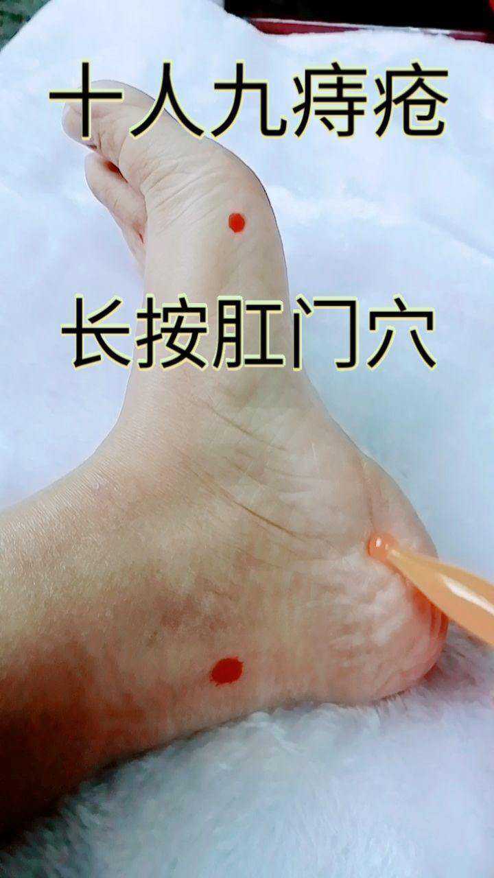 痔疮每天坚持按这个穴位有利改善