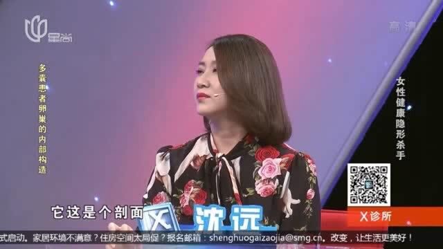 得了多囊卵巢症,子宫会变成什么样?专家带你正确认识