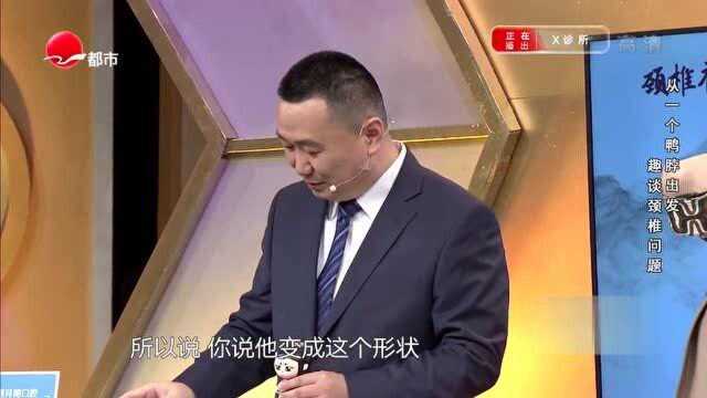 颈椎有7节?专家带你深入了解颈椎中的大力神,还有谁不知道