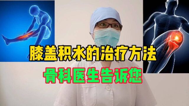 膝盖积水的治疗方法 ,骨科医生告诉您