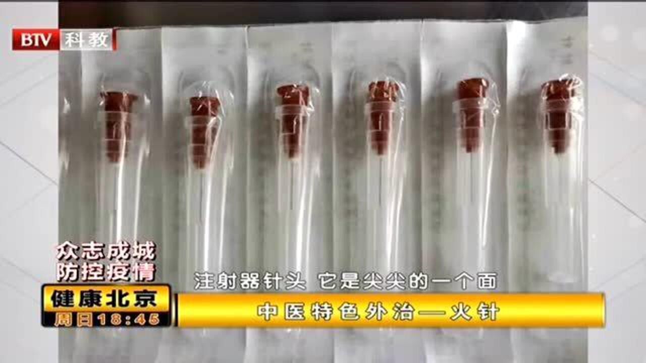 中医特色针刺放血，专家现场演示，操作手法很有讲究_腾讯视频
