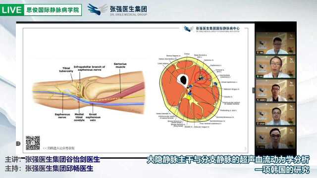 Journal Club 大隐静脉主干与分支静脉的超声血流动力学分析1