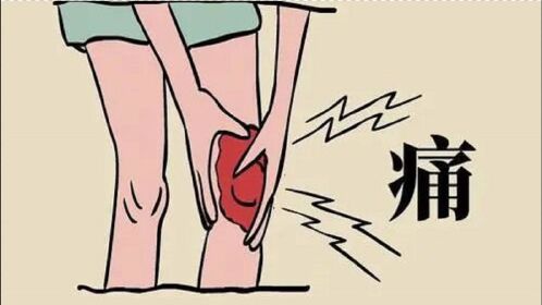 类风湿性关节炎的症状有哪些?