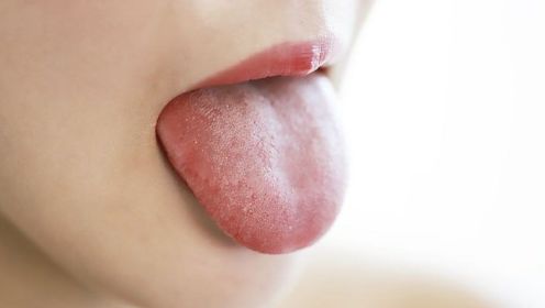 有这几种舌苔的人要注意了，这是身体发出的警示！