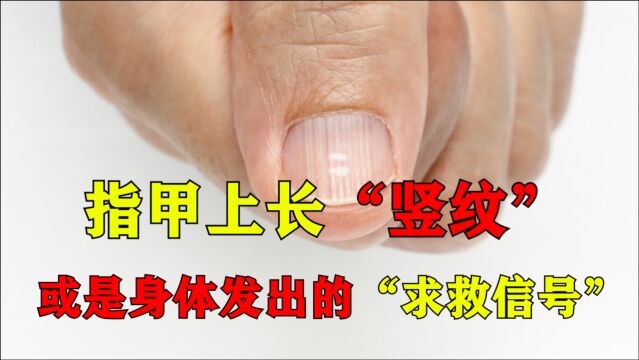 指甲上长“竖纹”,或是身体发出的“求救信号”,别忽视了