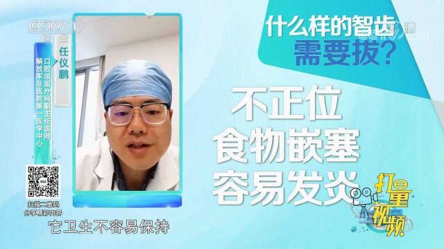 长了智齿都要拔掉吗?专家:这些情况下可以不拔