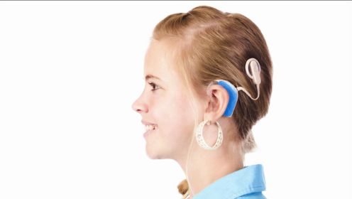 让无数人恢复听力！为什么说人工耳蜗是“人类最伟大的医学发明”