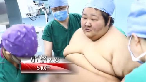 生命缘：540斤小伙被推进手术室，医生直言喉头一堵立马没命！