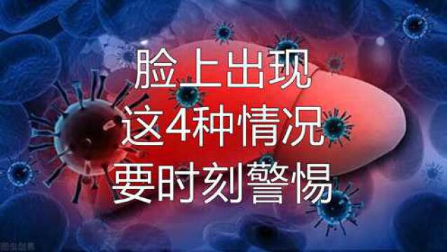 专家提示:若脸上出现这4种情况,肝病来了,要时刻警惕