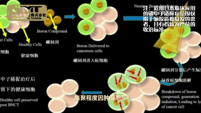 JMT日本先进医疗——硼中子效果的预测