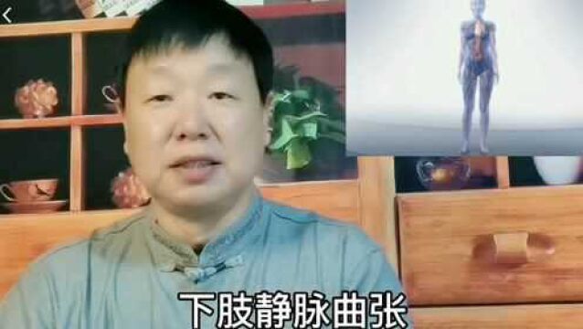 上集:静脉曲张是什么原因?防止腿部静脉的最佳方法有哪些?有哪些危害?