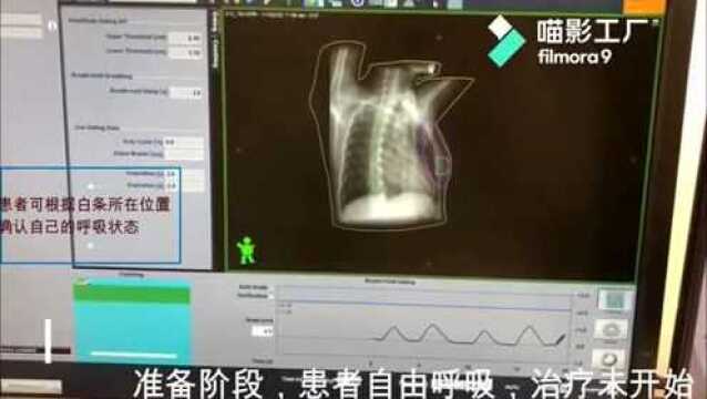 锁定肿瘤,心肺无忧——乳腺癌放疗DIBH技术在重庆三博长安医院ICON肿瘤放疗中心正式投入使用