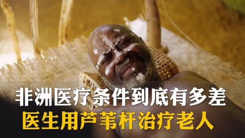 非洲医疗条件到底有多差！中国医生用芦苇杆救治老人，惊呆所有人