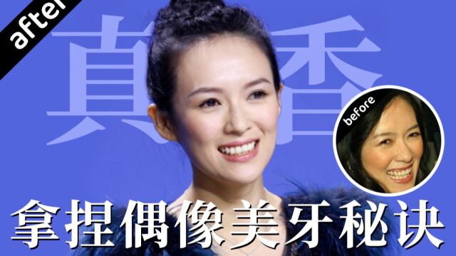 羡慕明星同款大白牙?业内人士才敢说的牙齿美白真话!