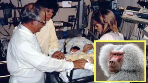 把动物心脏移植给人类？38年前一场惊天手术，竟给数万人带来希望