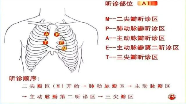 全科规培期中考1.心脏听诊