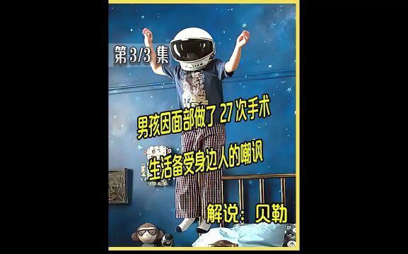 奇迹男孩:男孩因面部做了27次手术,生活备受身边人的嘲讽#电影解说 #贝勒电影 #奇迹男孩