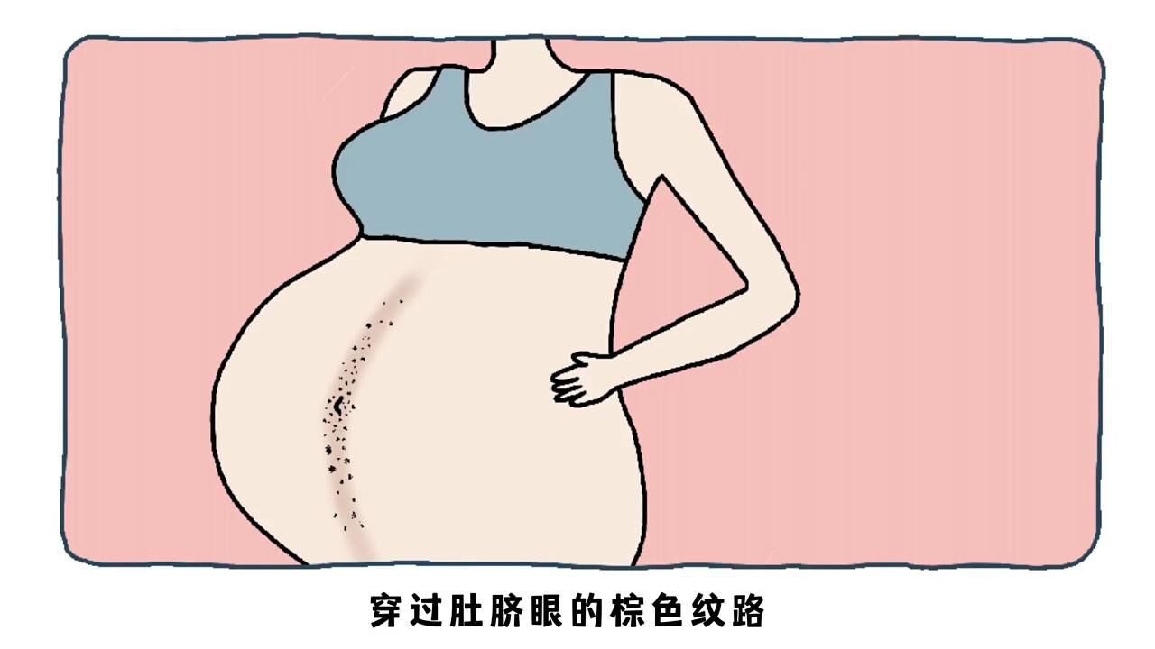 为什么很多女生的肚子上,都会有条竖线02