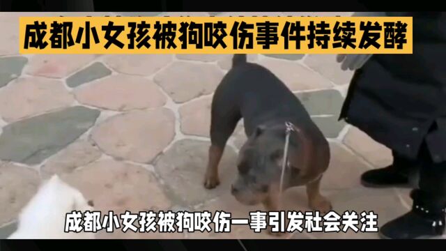 成都小女孩被狗咬伤事件持续发酵,文明养狗是公民的责任