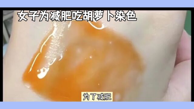 减肥女士面色变橘黄,医生警告:不要过度食用胡萝卜