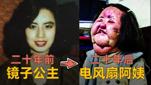 韩国电风扇阿姨，曾美过王祖贤，脸注入色拉油，整容上瘾面部全毁