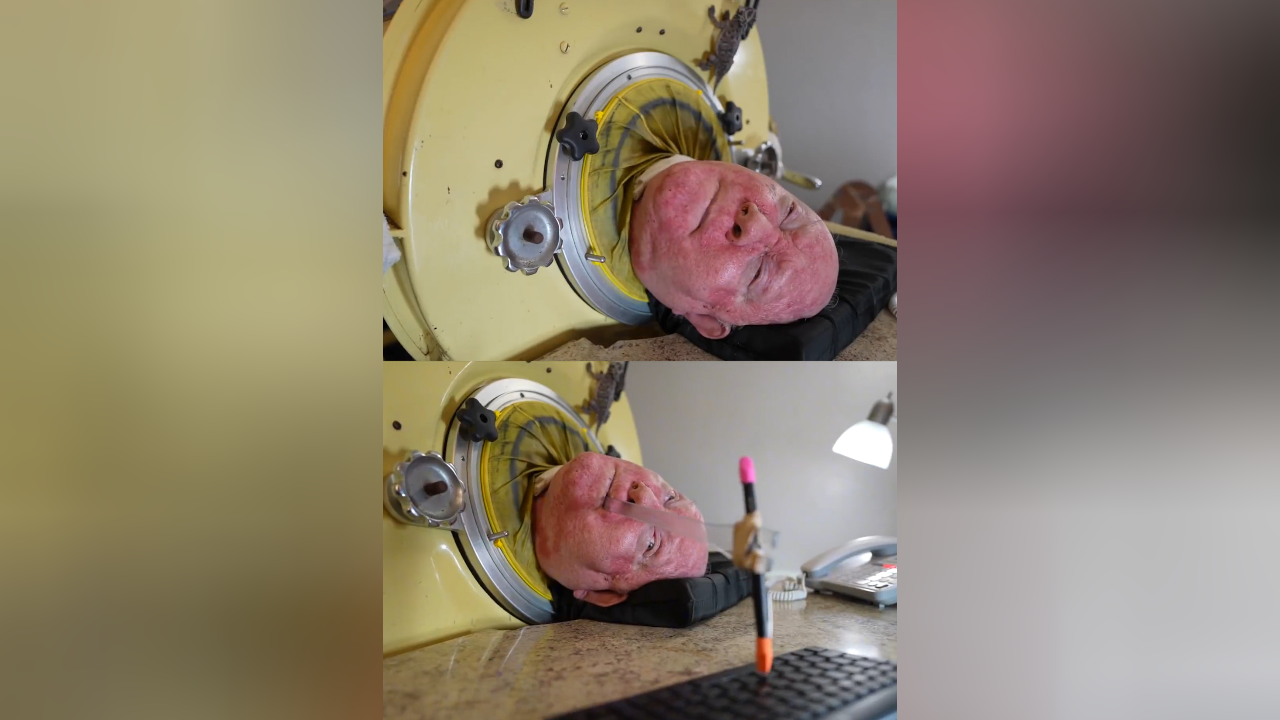 美国77岁男子靠"铁肺"生活70年创吉尼斯世界纪录:我不想死,会一直抗争