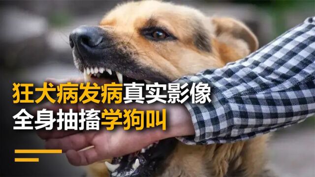 狂犬病发病真实影像,全身抽搐学狗叫,每年超过5500人死亡!