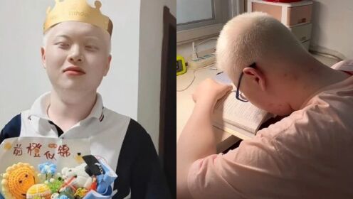 白化病少年高考688分被清华录取:上课靠望远镜,用放大镜看书