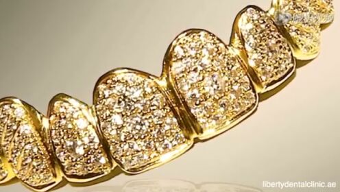 世界最昂贵的黄金钻石土豪大金牙