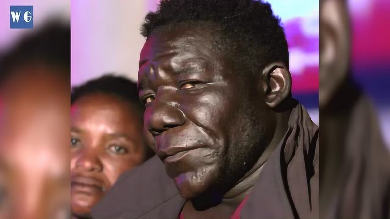 世界最丑男人:四届选丑冠军 被人抗议不准参赛了