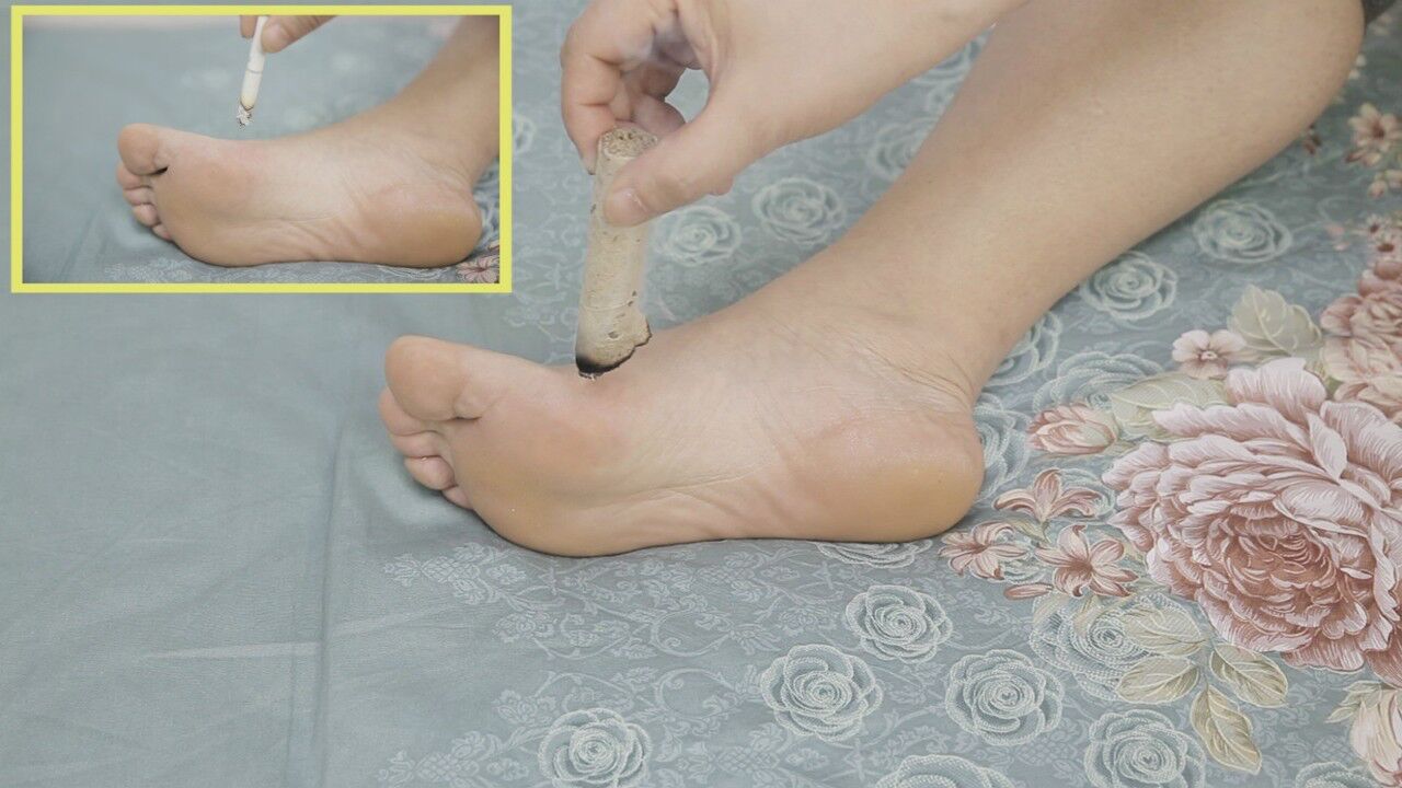 脾虚容易肥胖坚持艾灸脚上这个穴位健脾化湿