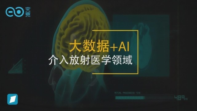 “眼疾手快”的放射科医师助手 AI诊断能否成为患者福音?