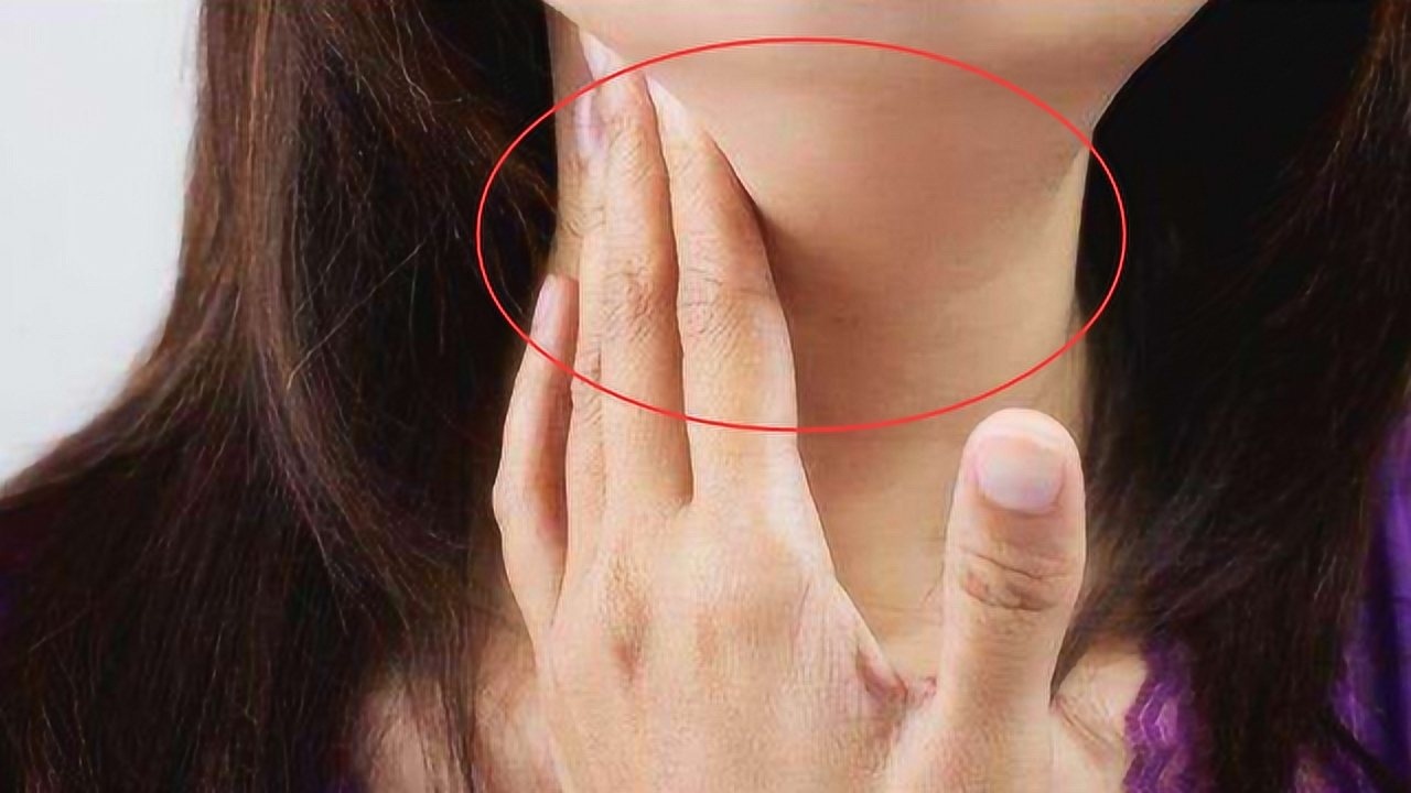 淋巴癌早期不疼不痒,一旦脖子出现这东西,说明体内有癌细胞了