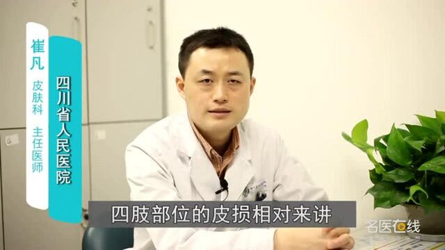 扁平疣最佳治疗方法是什么