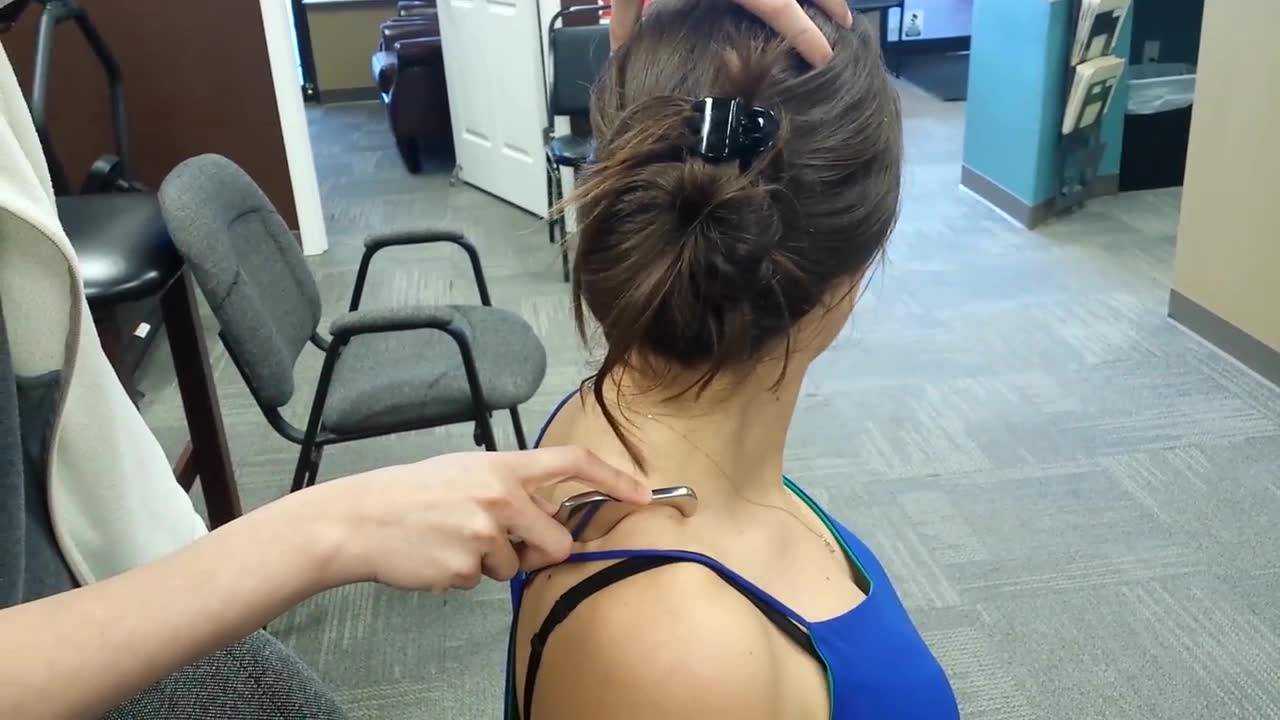 筋膜刀放松肩胛提肌