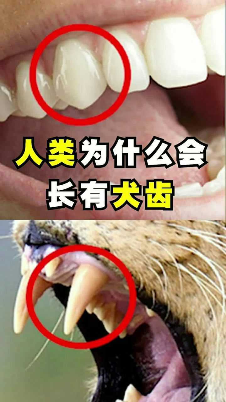 人类为什么会长有犬齿!喜欢的话,就帮鱿鱼点个双击呗!