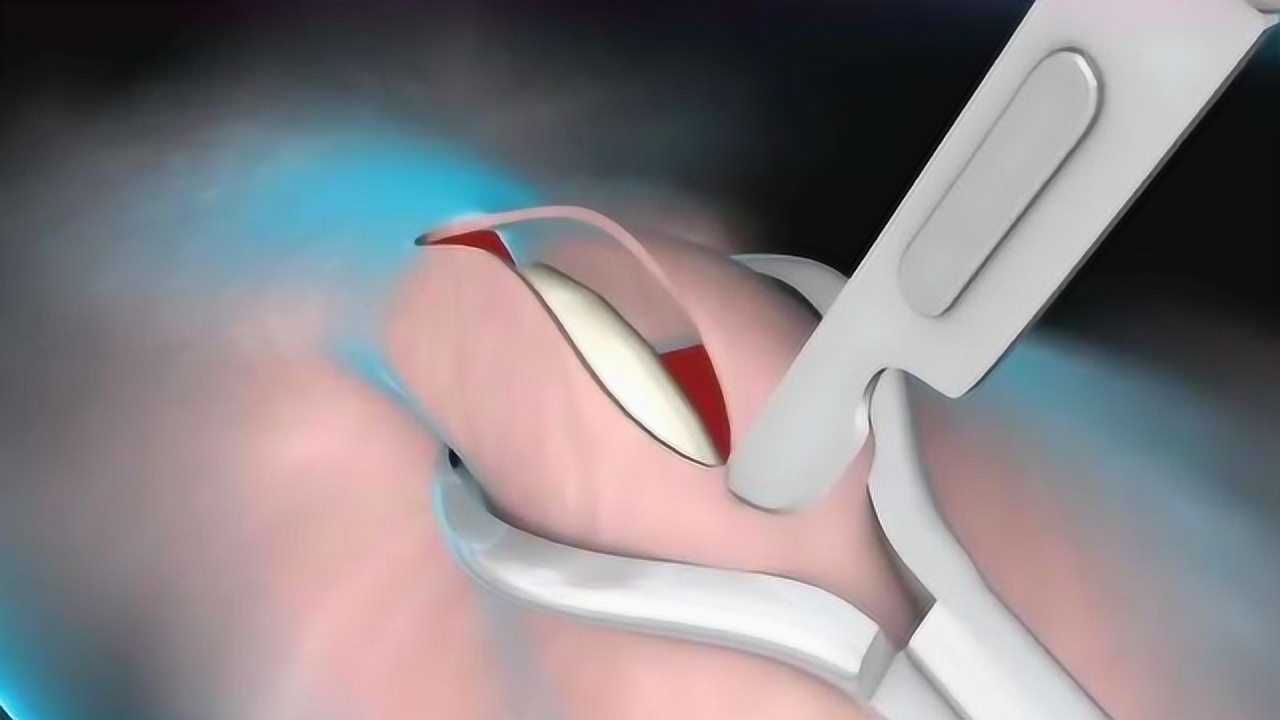 成年人都该明白,看着就疼!_腾讯视频