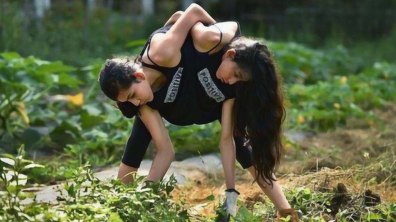 连体人中的一个如果去世了另一个会怎样网友接受不了