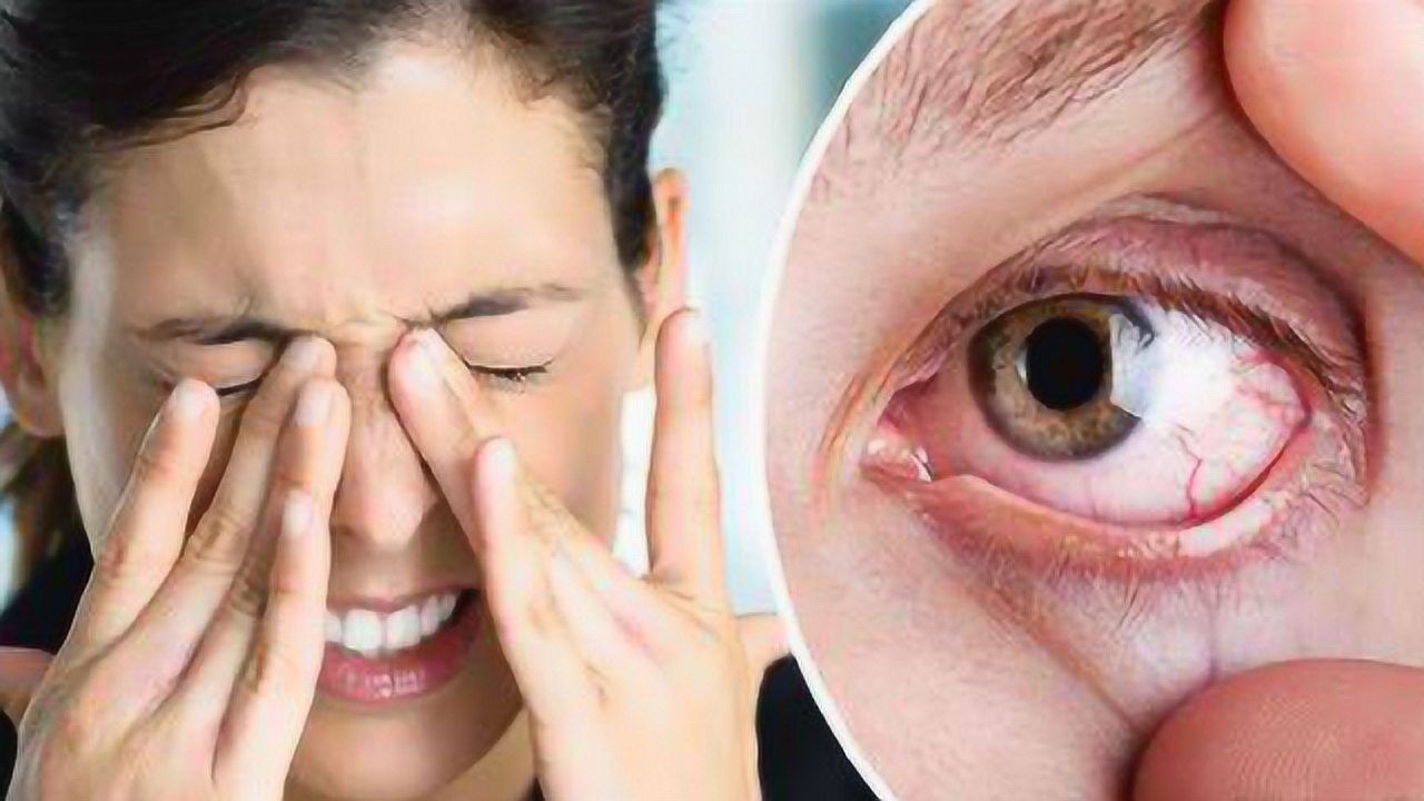 眼睛干涩疲劳是什么原因引起的?