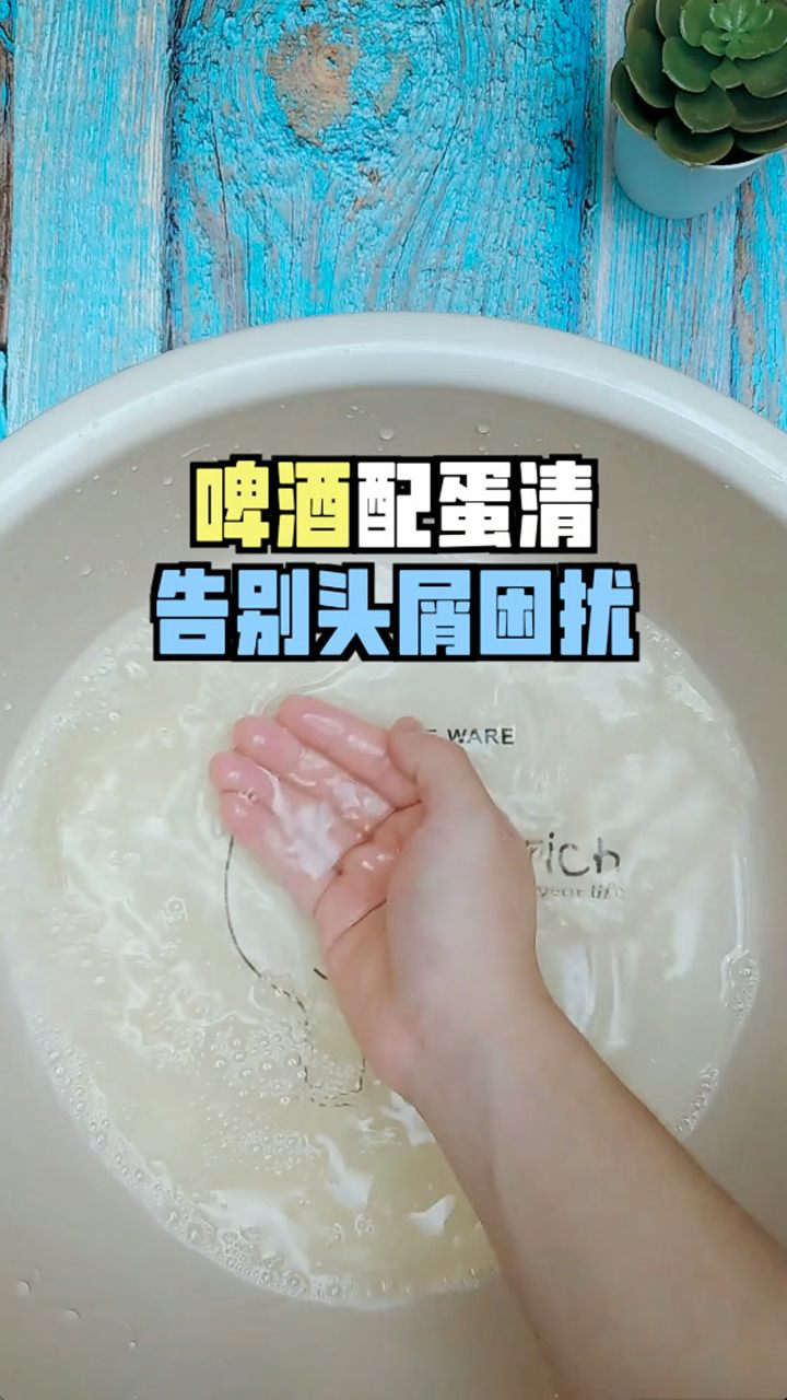 头皮屑过多怎么去除用啤酒洗头效果好