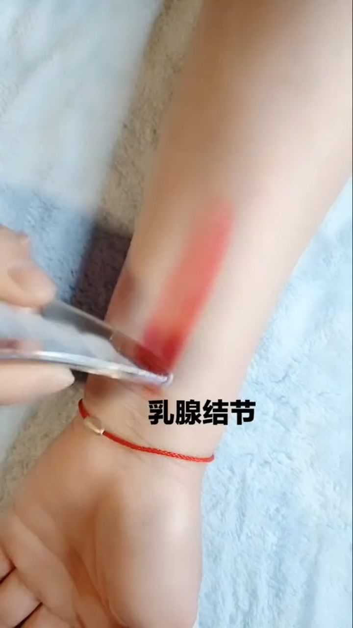 学会按摩这个穴位乳腺结节和乳腺增生都可以改善哦