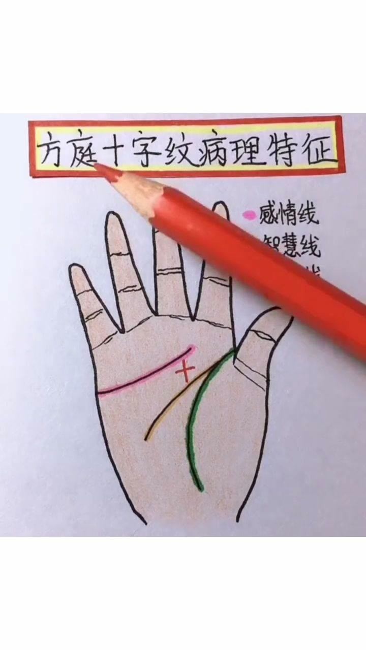 快来看手掌里的方庭十字纹病理特征