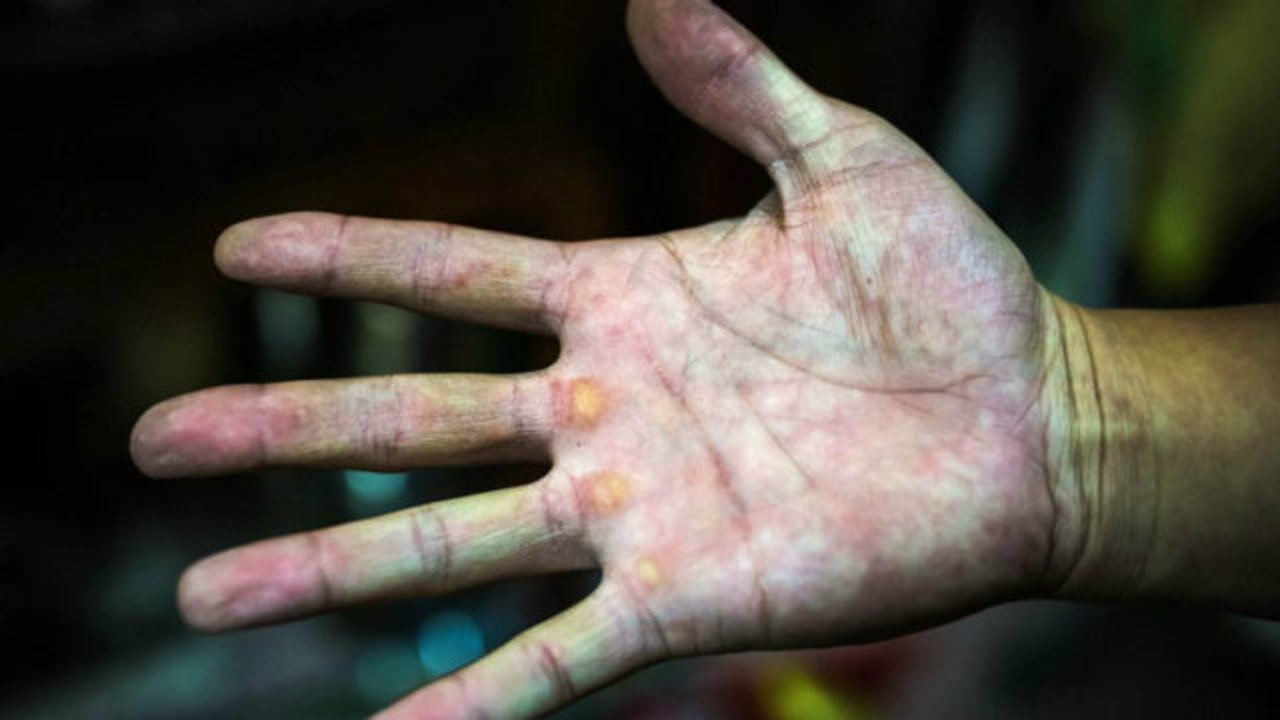 手上粗糙发硬的老茧,可不要刮,用家里的它搓一搓轻松去除老茧