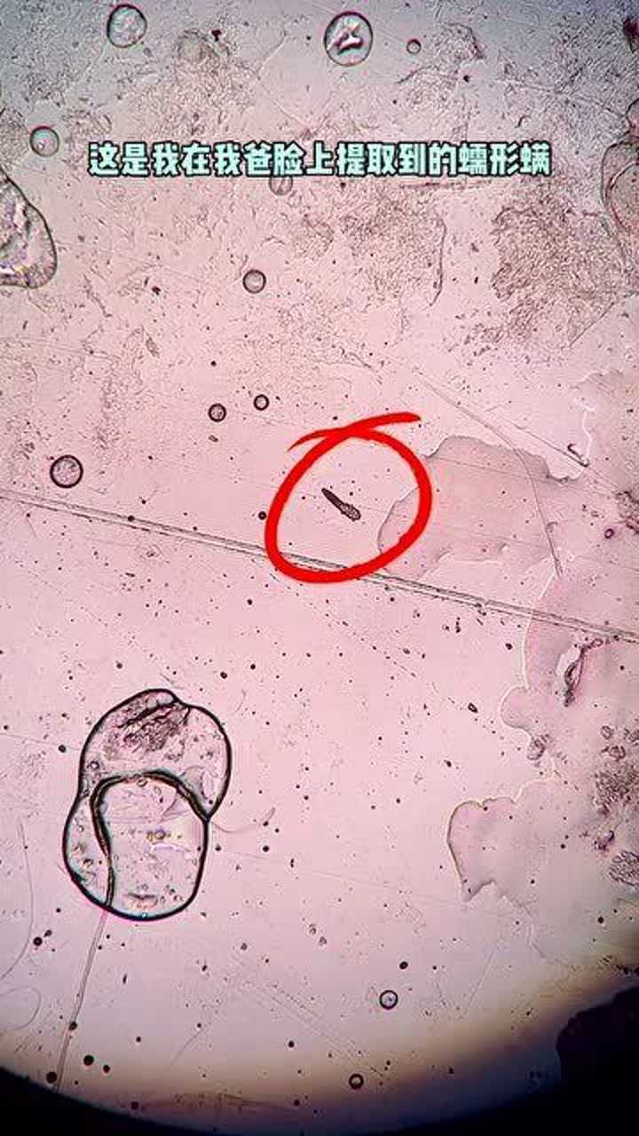 显微镜下放大500倍的螨虫生命力太顽强了硬刚硫磺皂丝毫不怂